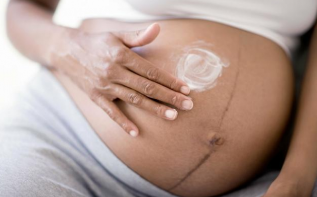 预防妊娠纹的方法有哪些