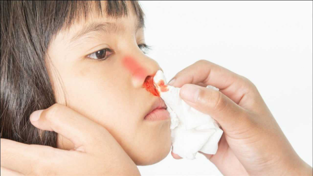 儿童流鼻血什么原因 小孩流鼻血咋回事