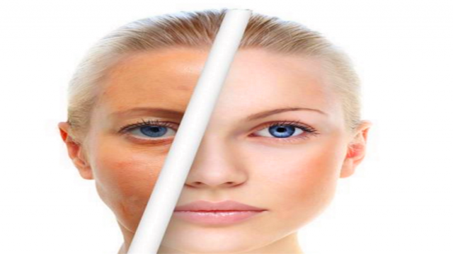 解析肤质秘密：摆脱黄脸婆困扰，打造健康光彩肌肤